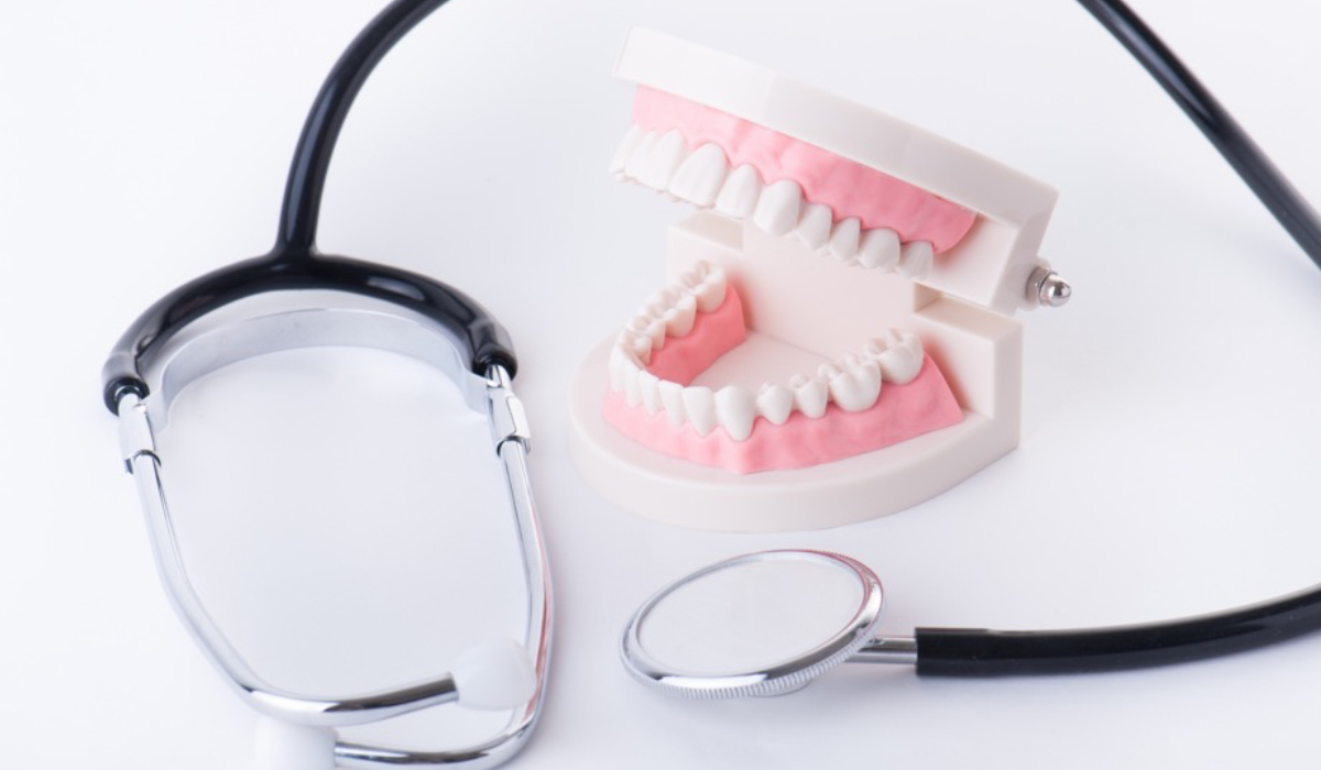 前歯をインプラントするべきか？