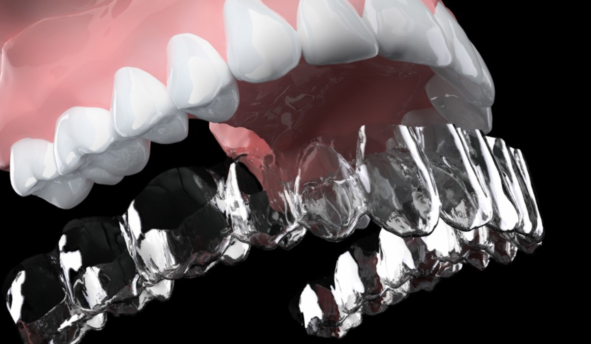 矯正歯科の種類