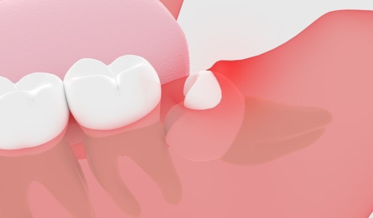 医師の診察を受ける時期